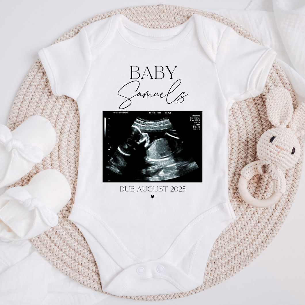 Ultrasound scan custom personalized baby grow baby pregnancy announcement onesie